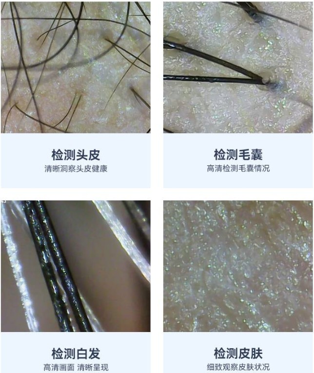 頭皮檢測儀的功能效果